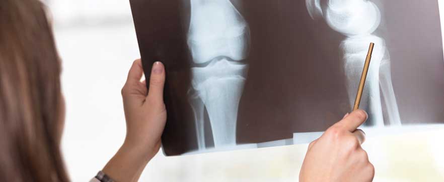 menopause vitamins for healthy bones